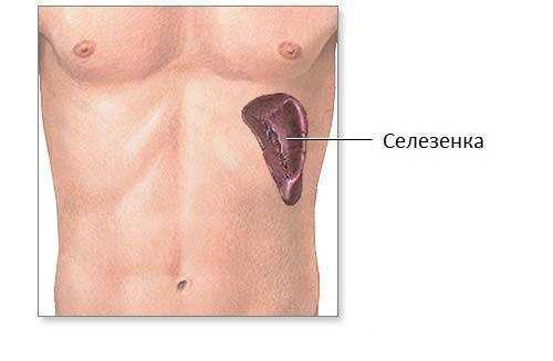 Воспаление селезёнки: симптомы, причины