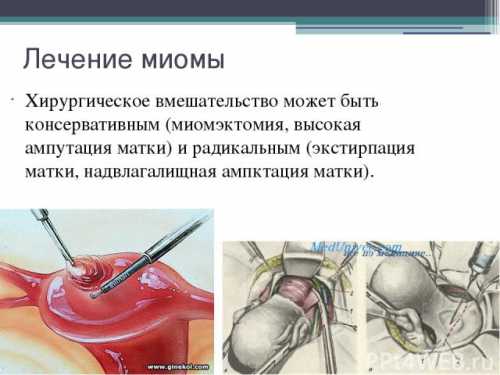 Увеличение количества и изменение консистенции выделений к более жидкому состоянию также могут быть поводом для обращения к гинекологу