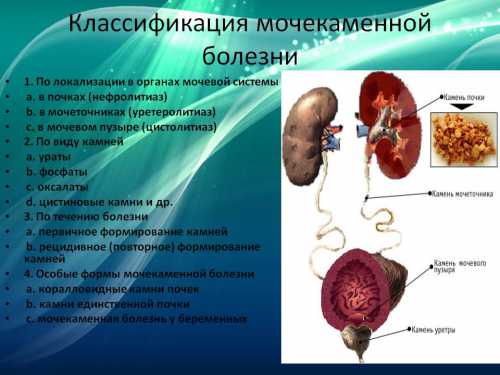 Диета при уратных камнях должна быть с ограничением мясных продуктов, ткмочевина является продуктом обмена белков