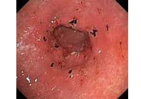 В дополнение к этому у него есть много других полезных свойств