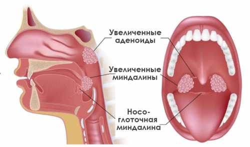 Длится такая операция минут