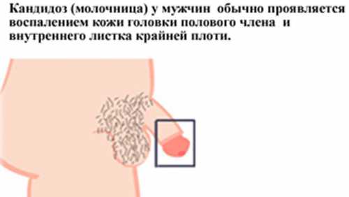 Налёт может быть в виде плёнки или порошка