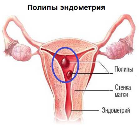 Если образование не помешало зачатию, оно не будет помехой и для нормального развития малыша