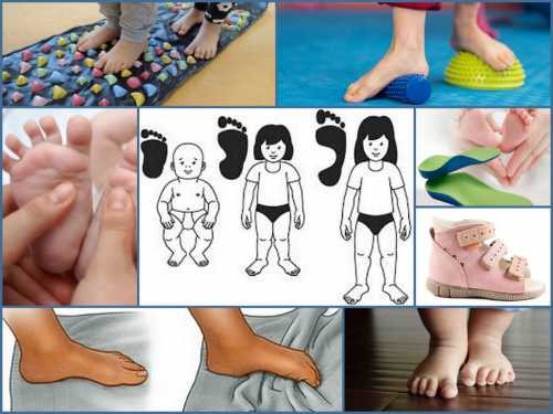 Согласно ряду исследований и статистике ученых, плоскостопием болеют дети в три раза чаще те, которые постоянно носят обувь